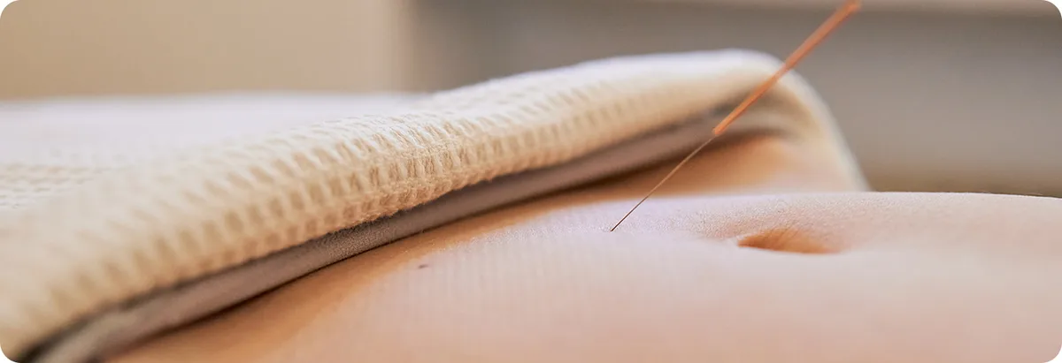하복부 침 시술 · 와봄한방병원 여성 진료